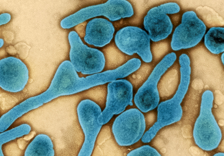 La enfermedad del virus de Marburgo: ¿qué es y cómo afecta a los humanos? la-enfermedad-del-virus-de-marburgo-que-es-y-como-afecta-a-los-humanos-083716-083722.png