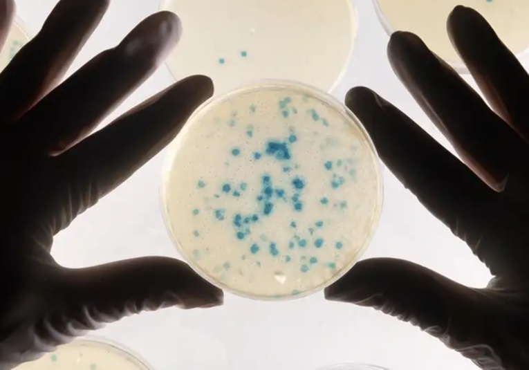 Logran entrenar a bacterias para que detecten cáncer logran-entrenar-a-bacterias-para-que-detecten-c-ncer-121205-121238.jpg